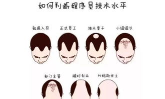 发际线有救了,新技术让脱发成为过去,重新找回自信和青春的秘诀曝光